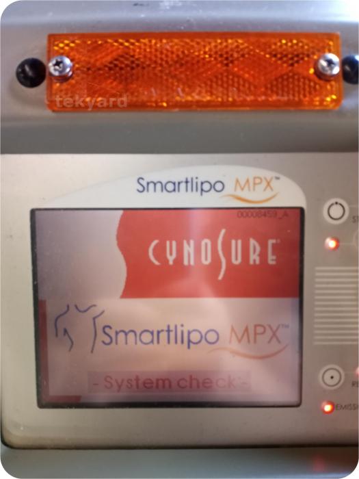Cynosure Smartlipo MPX Body Contouring Liposuction