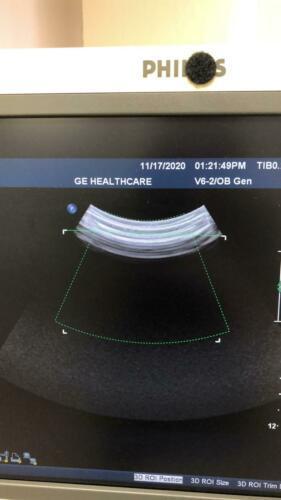 Philips V6-2 3D/4D Ultrasound Probe / Transducer