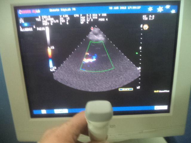 ESAOTE PA230E Ultrasound Transducer