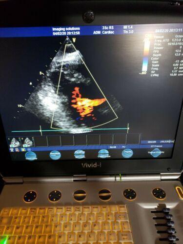 GE 3SC-RS Ultrasound Transducer