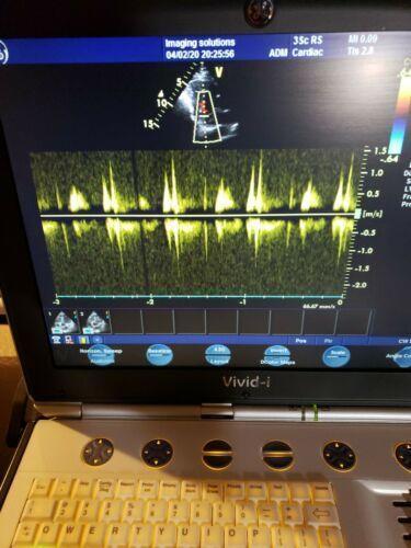 GE 3SC-RS Ultrasound Transducer