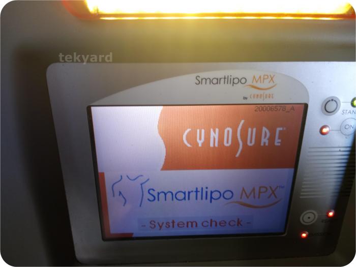 Cynosure Smartlipo MPX Body Contouring Liposuction