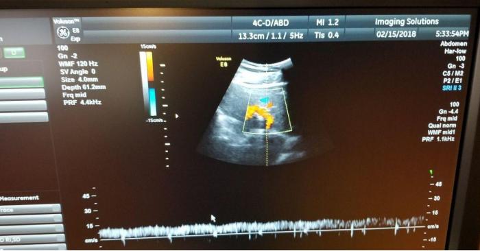 GE 4C-D Ultrasound Transducer