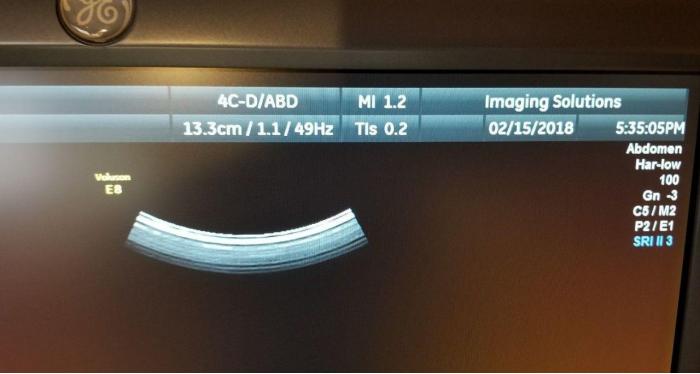 GE 4C-D Ultrasound Transducer