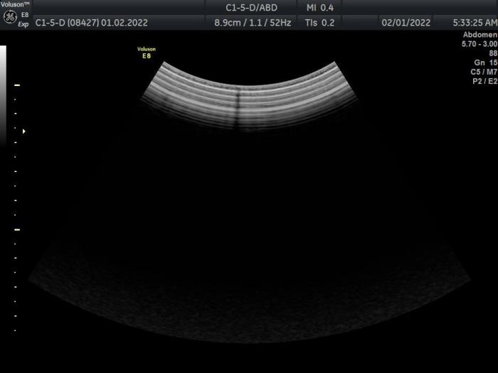 GE C1-5D