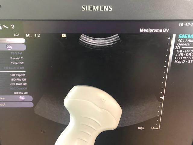 SIEMENS 4C1