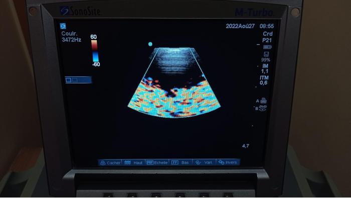 SONOSITE P21x