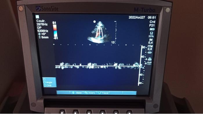 SONOSITE P21x