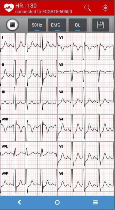 NORAV MEDICAL ECG Blue