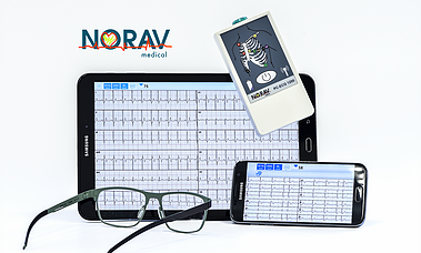 NORAV MEDICAL ECG Blue