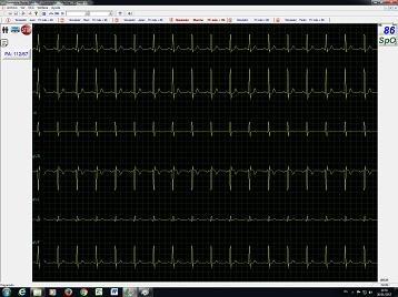 NORAV MEDICAL NM700BT