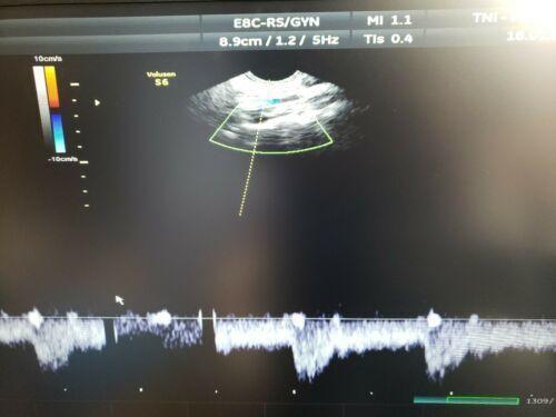 GE E8C-RS Ultrasound Transducer