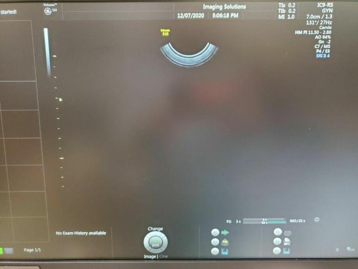 GE IC9-RS Ultrasound Transducer