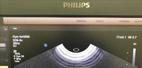 PHILIPS 3D9-3V