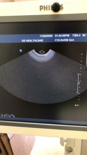 Philips C10-3V Ultrasound Transducer for iU22