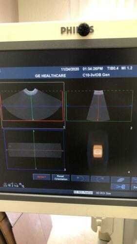 Philips C10-3V Ultrasound Transducer for iU22