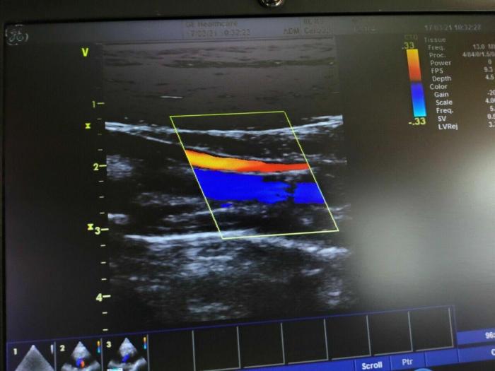 GE 8L-RS Ultrasound Transducer