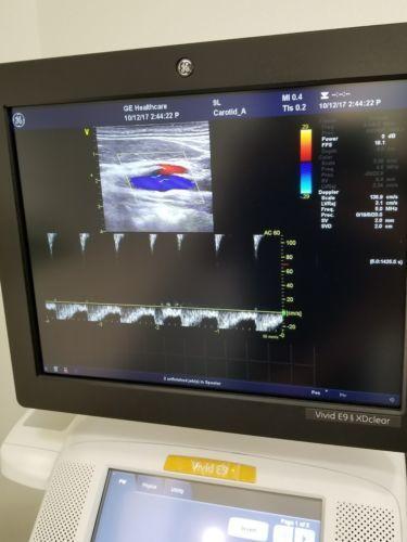 GE 9L-D Ultrasound Transducer