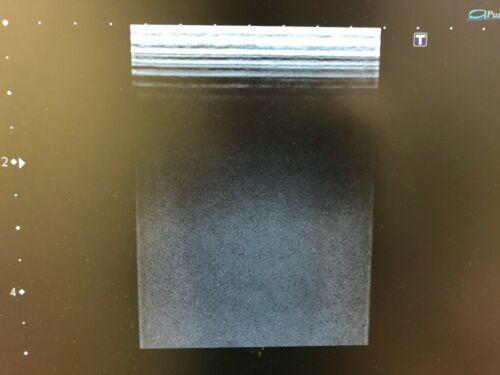 TOSHIBA PLT-704AT 7.5MHz LINEAR ARRAY TRANSDUCER