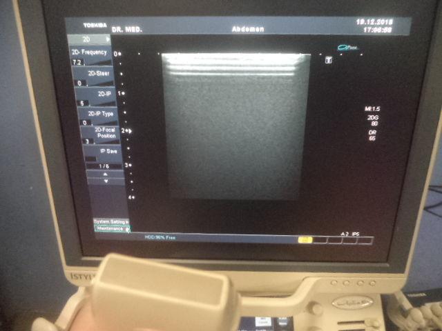 TOSHIBA PLT-704SBT Ultrasound Transducer