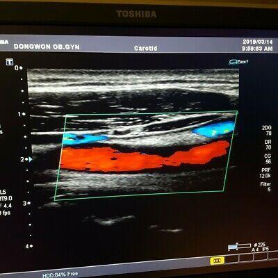 TOSHIBA PLT-805AT Ultrasound Transducer