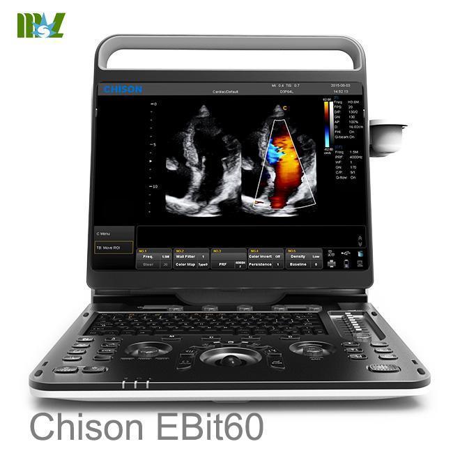 CHISON EBit 60