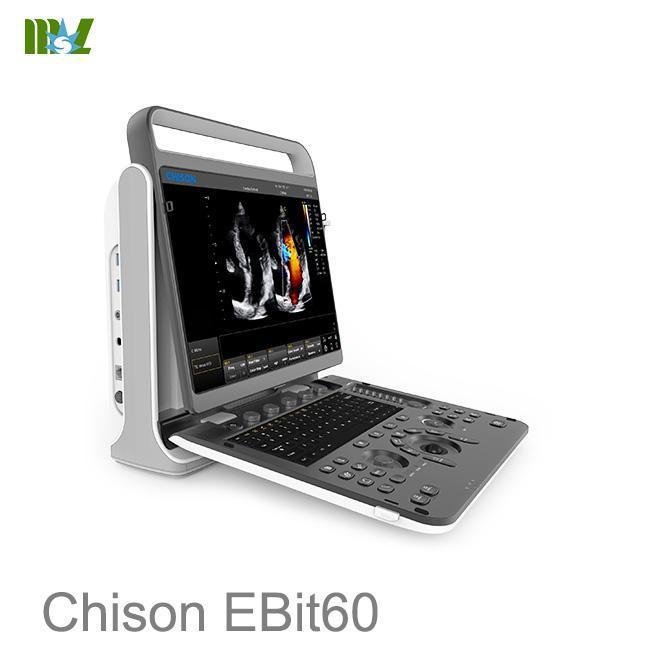 CHISON EBit 60