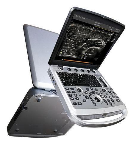 CHISON Sonobook 6