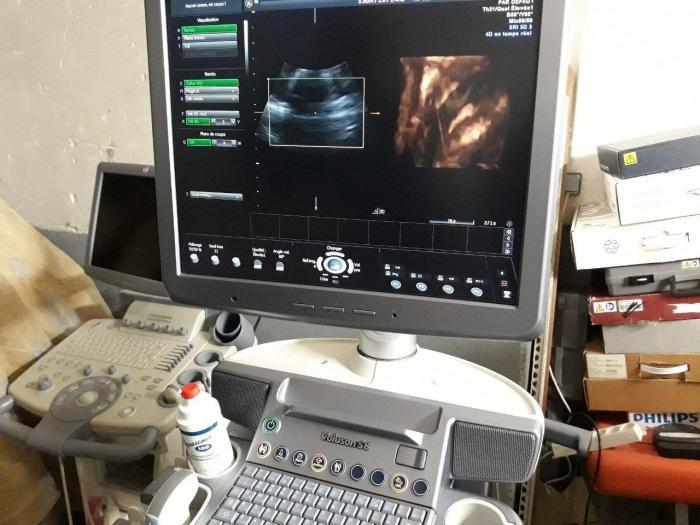 GE Logiq S8 OB / GYN – Vascular Ultrasound