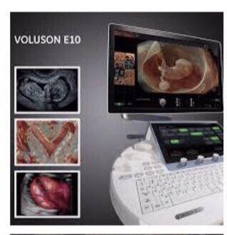 GE Voluson S10 OB / GYN Ultrasound