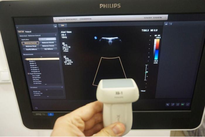 PHILIPS EPIQ 7