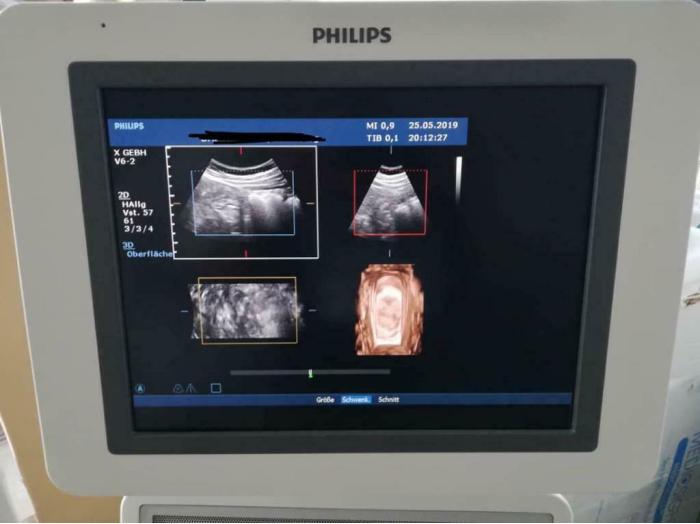 PHILIPS HD 15