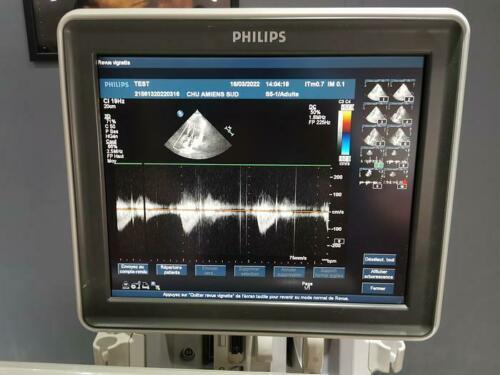 PHILIPS IE33