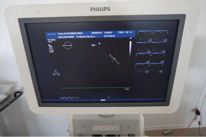 PHILIPS IE33