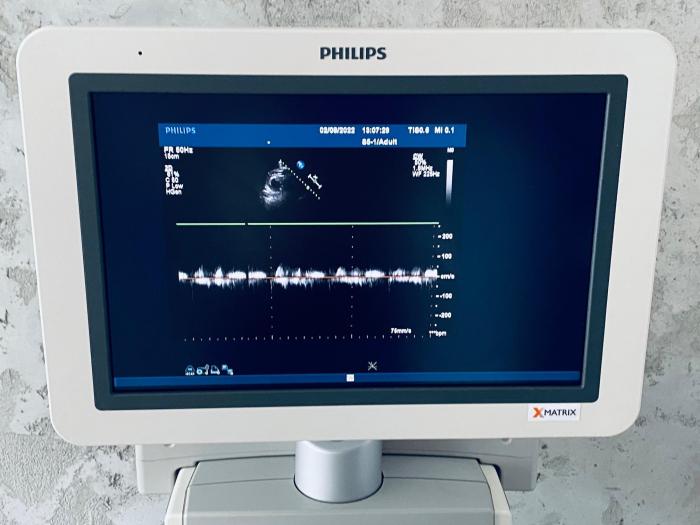 PHILIPS IE33