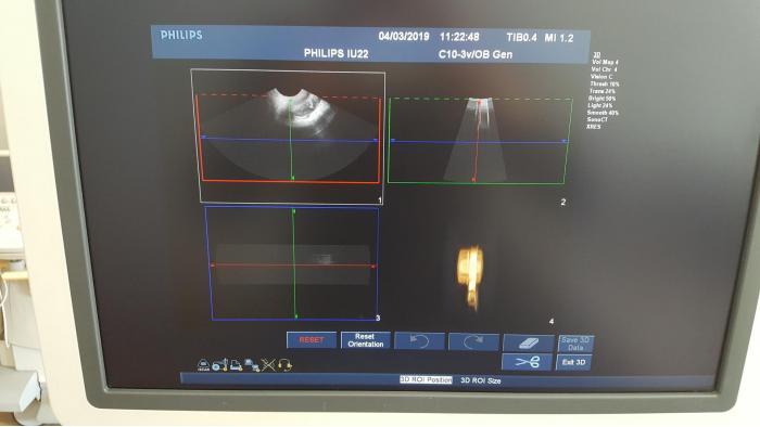 Philips iU22 G.1 2011 FULL OPTIONS Cardiac Endovaginal ETC