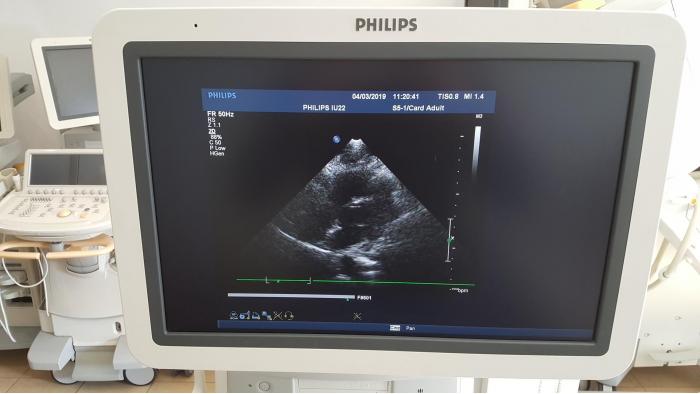 Philips iU22 G.1 2011 FULL OPTIONS Cardiac Endovaginal ETC