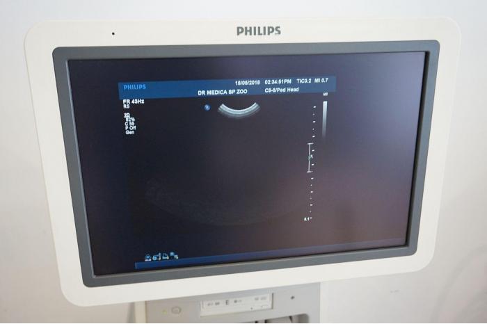 PHILIPS iU22