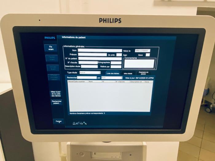 PHILIPS iU22