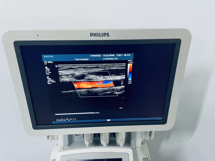 PHILIPS iU22