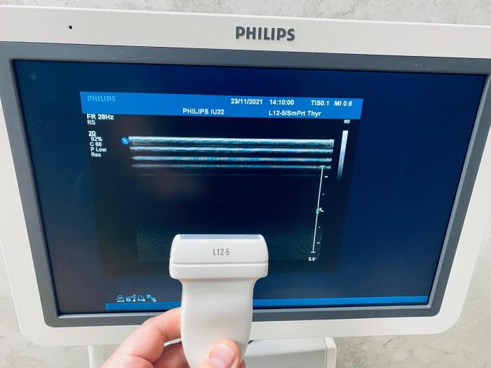 PHILIPS iU22