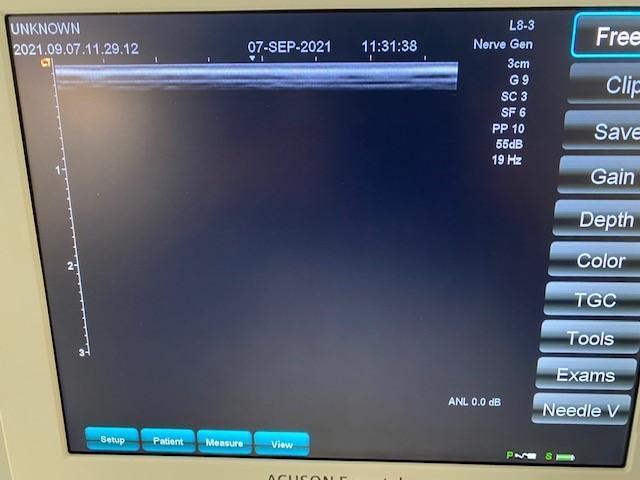 SIEMENS ACUSON Freestyle