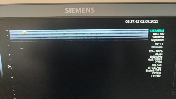 SIEMENS ACUSON S2000 HELX Touch