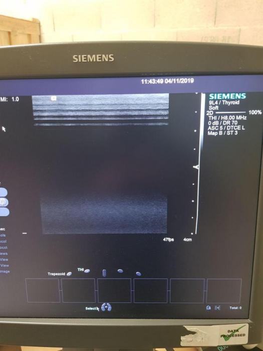 Used SIEMENS S2000 OB / GYN – Vascular Ultrasound