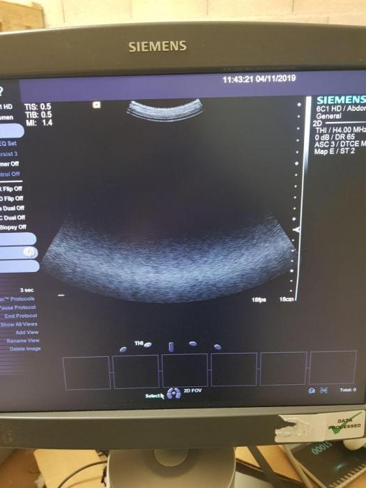 Used SIEMENS S2000 OB / GYN – Vascular Ultrasound