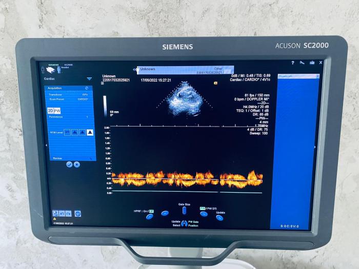 SIEMENS ACUSON SC2000