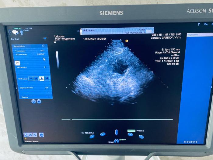 SIEMENS ACUSON SC2000