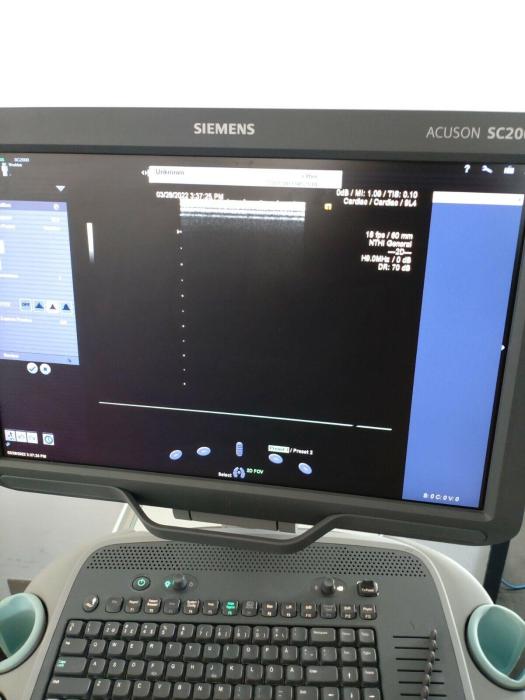 SIEMENS ACUSON SC2000