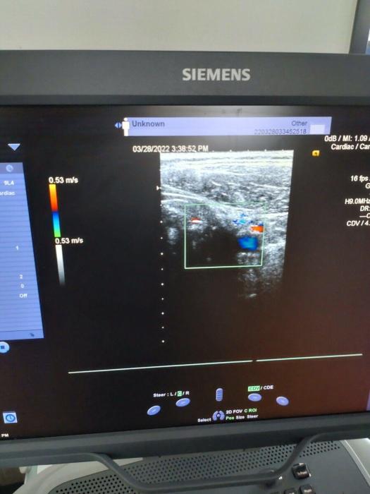 SIEMENS ACUSON SC2000