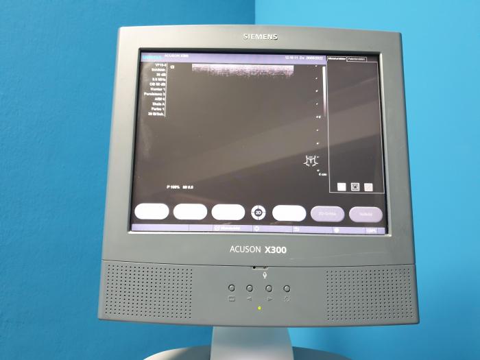 SIEMENS ACUSON X300